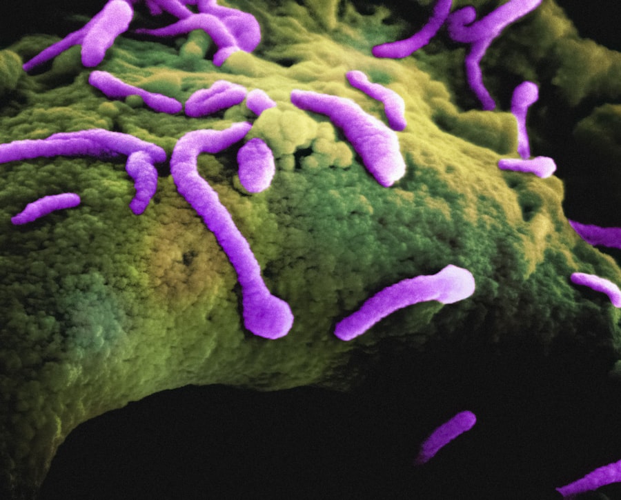 FDA approves new antibiotic for UTIs