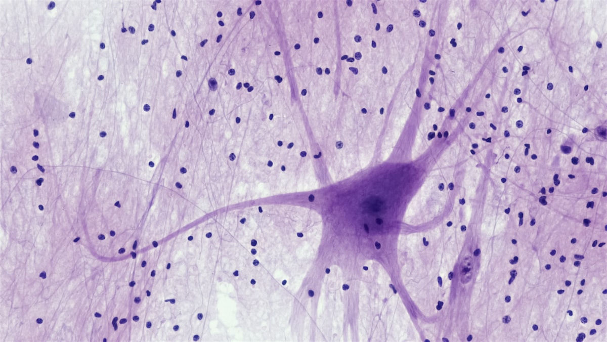 Trained Immunity: Vaccines May Shield Brain From Dementia
