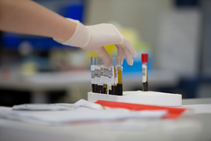 Blood test detects early Parkinson's