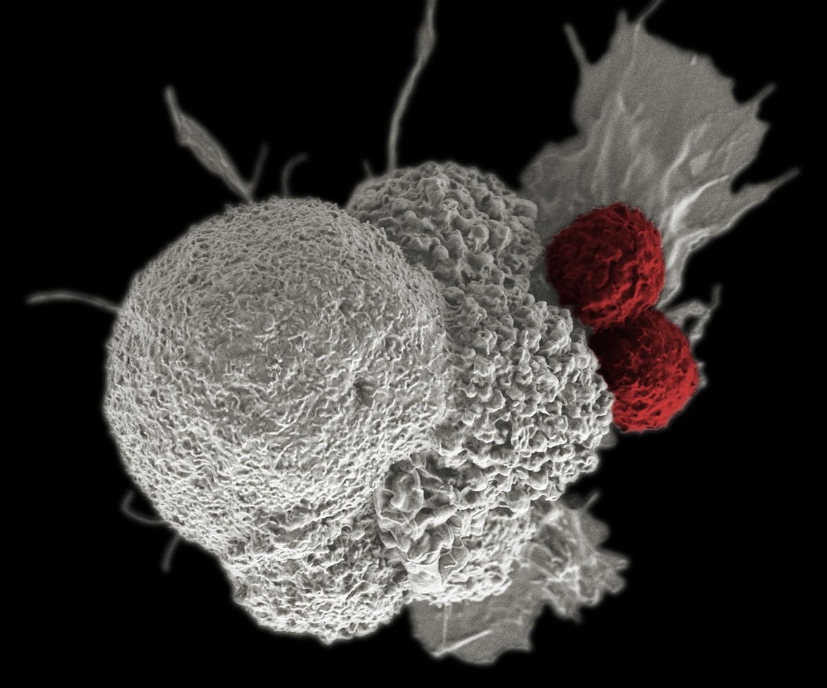 Cancer Escape Trick Discovery: A Reality