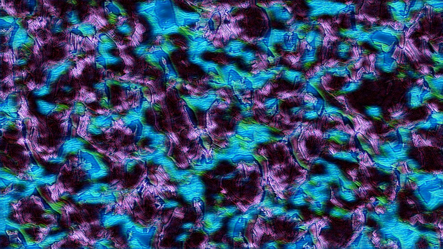 FDA halts Alzheimer's drug trial on safety and data concerns