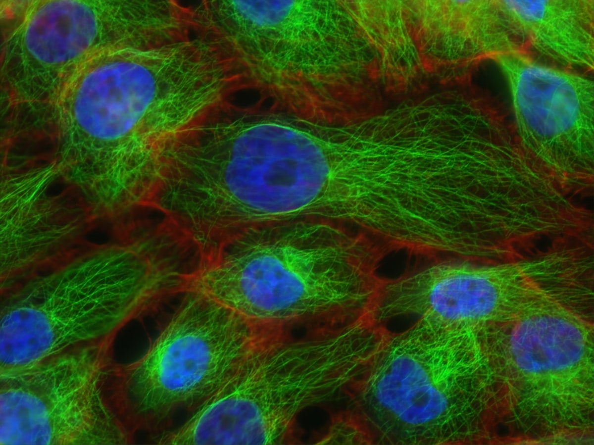 Vitamin B12 therapy shows promise for glioblastoma