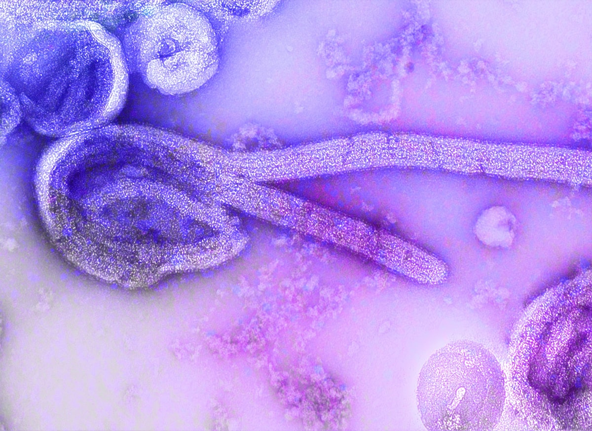 How Bacteroides fragilis Toxin Triggers Colon Cancer