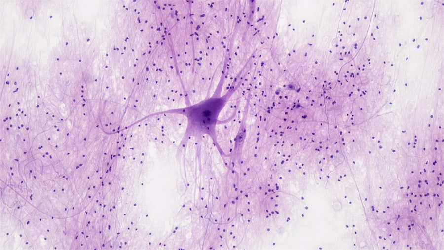 FDA approves new Alzheimer's drug