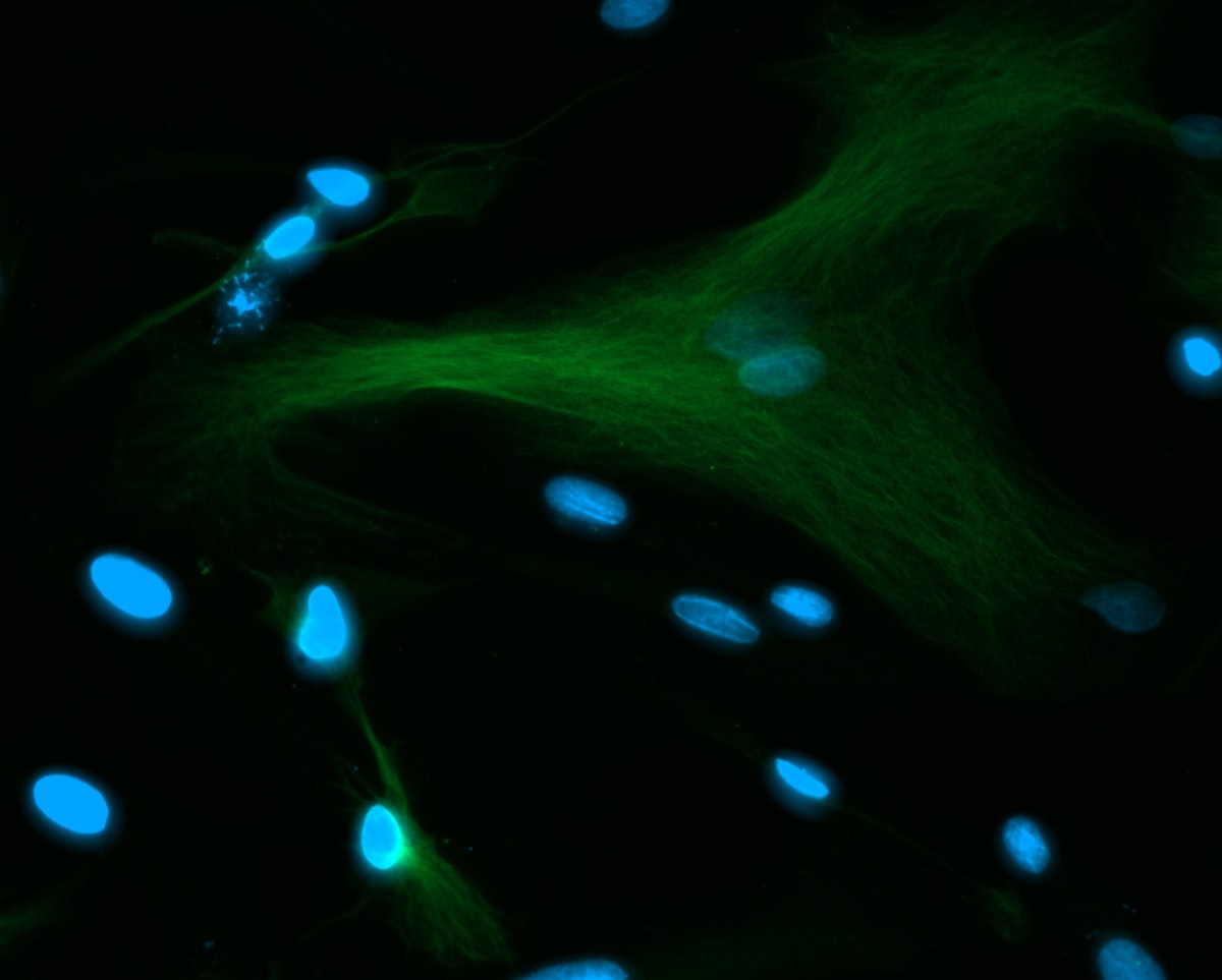 Mycorrhizal fungal networks weigh 5x all