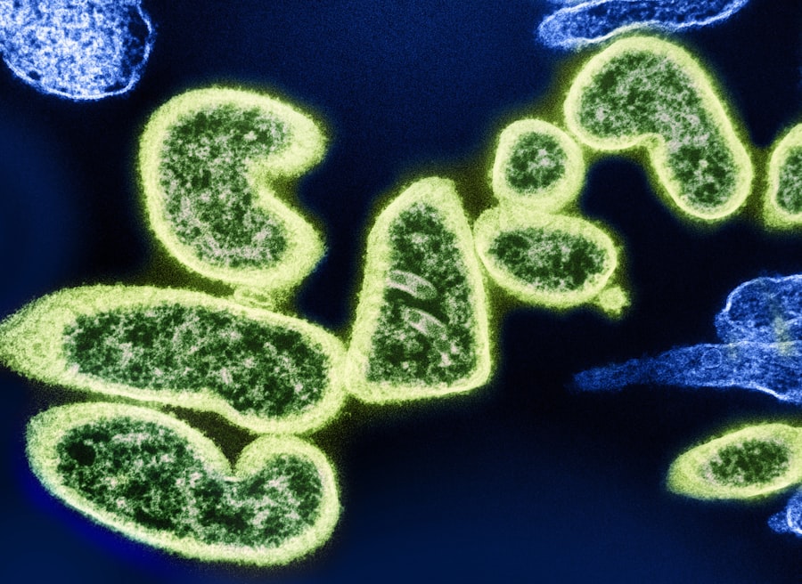 CRISPR sickle cell approval: a cure with a catch
