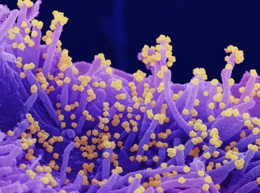 H5N1 bird flu spread: Nebraska dairy herd infected