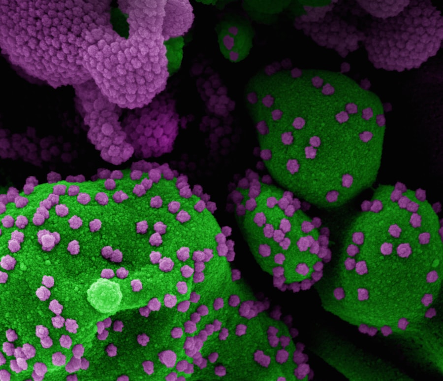 H5N1 in US: First severe case sparks alarm
