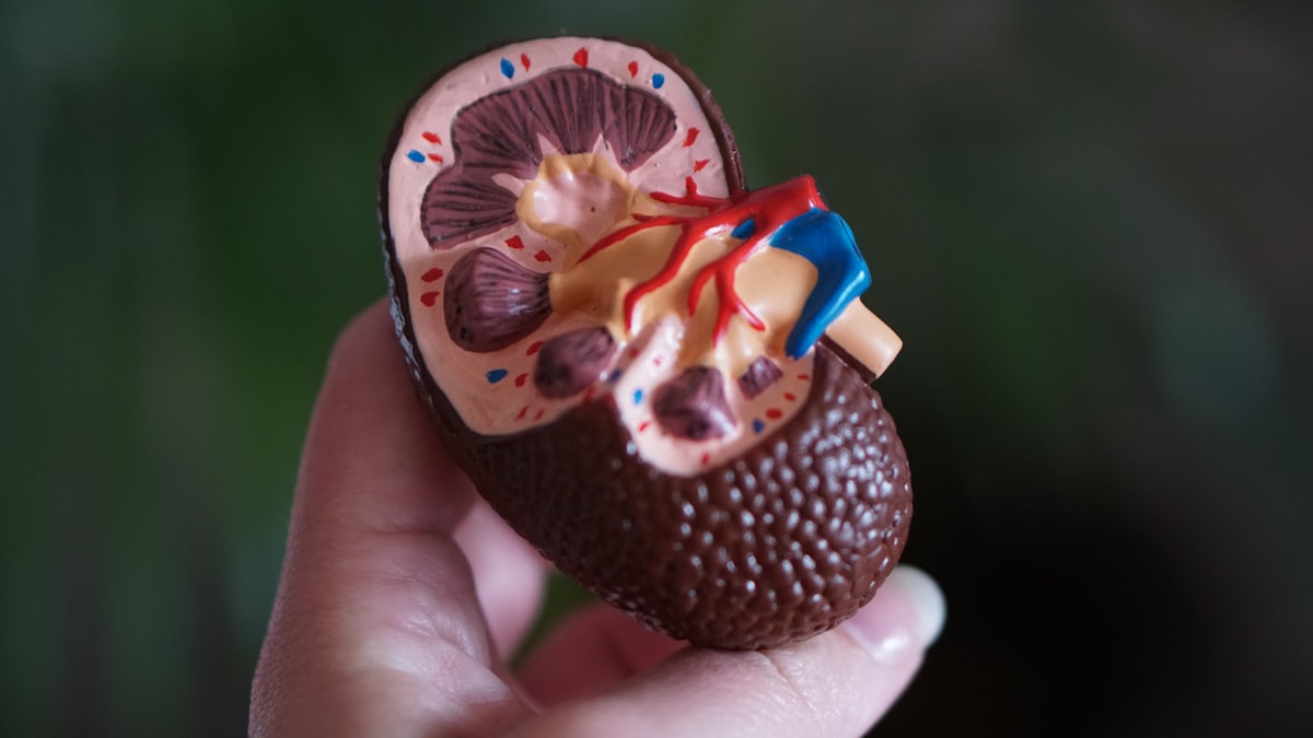 NYU Study Reveals Kidney Transplant Barriers