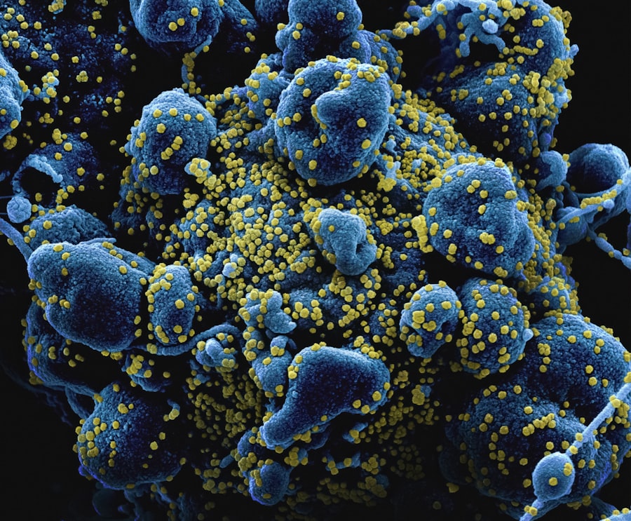 H5N1 bird flu: Nebraska dairy infected
