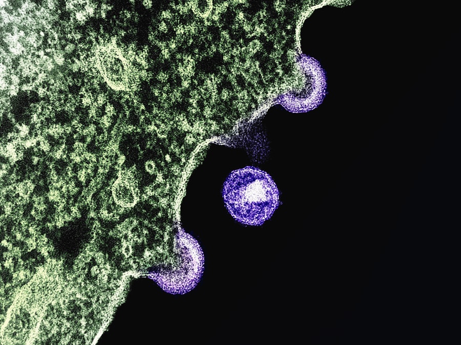 H5N1 bird flu: how severe case sparks new alarm
