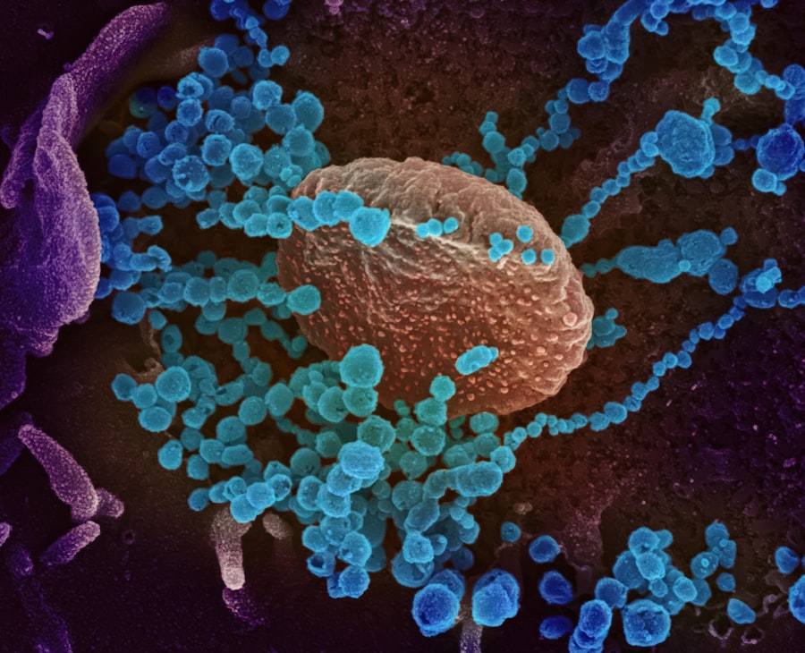 H5N1 bird flu: first US human death